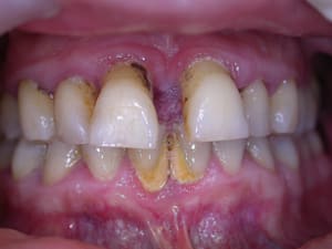 Dscn3426a wrtxqx - Eugenol