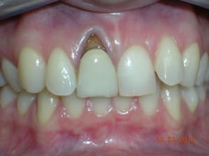 Dscn5231 tlb8kt - Eugenol