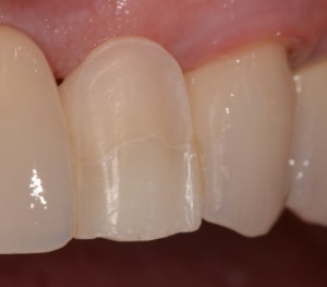 Dsc 0005 oq6wgr - Eugenol
