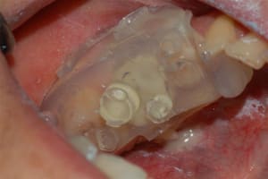 Dsc 0011 wzp6hw - Eugenol