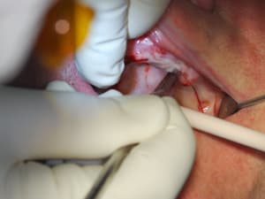 Dsc 0013 uxosog - Eugenol