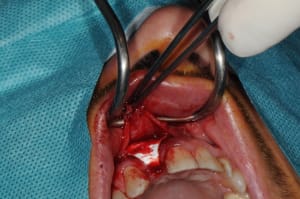 Dsc 0020 fxuf2s - Eugenol
