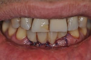 Dsc 0030 xv8oq1 - Eugenol