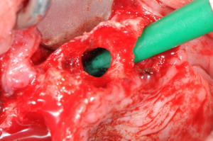 Dsc 0031 hcuc6e - Eugenol