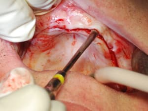 Dsc 0041 lcy2rk - Eugenol