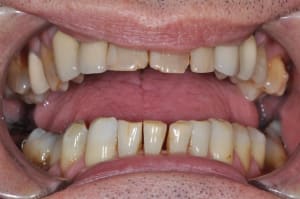 Dsc 0041 pgt5cr - Eugenol