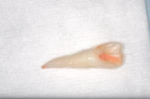 Dsc 0041 prwbnq - Eugenol