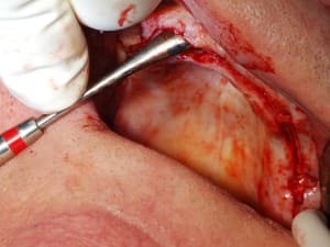 Dsc 0090 g0gqn8 - Eugenol