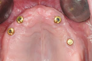 Dsc 0091 fjssjx - Eugenol