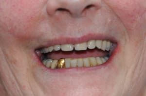 Dsc 0323 rbae6b - Eugenol