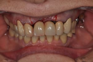 Dsc 0330 xjsth1 - Eugenol