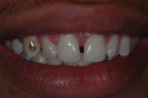 Dsc 0763 neoc0i - Eugenol