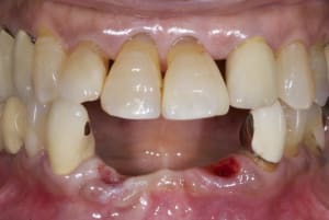 Dsc 1201 n5ogzl - Eugenol