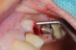 Dsc 1548 lhclbj - Eugenol