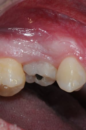 Dsc 1968 lxhxp4 - Eugenol