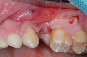 Dsc 2109 fzrsjo - Eugenol