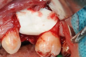 Dsc 2139 ljgowm - Eugenol