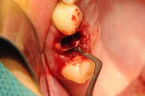Dsc 2556 hojfbk - Eugenol