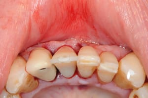 Dsc 2566 hva5o8 - Eugenol