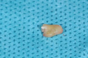 Dsc 2788 t4ywjq - Eugenol