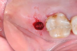 Dsc 2856 qb1vkl - Eugenol