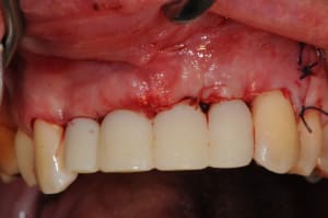 Dsc 3022 zqfcok - Eugenol
