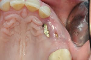 Dsc 3570 wci64f - Eugenol