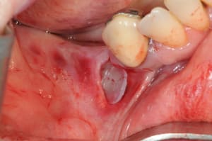 Dsc 3819 qxzgap - Eugenol