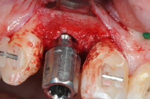 Dsc 4065 z6suqv - Eugenol