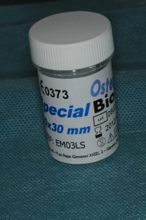Dsc 4595 uxmest - Eugenol