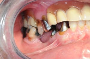 Dsc 4698 g5eors - Eugenol