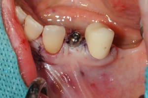 Dsc 5058 wnfdrv - Eugenol