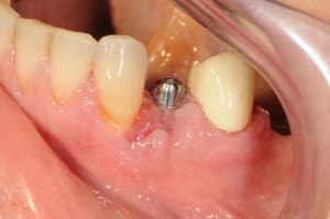 Dsc 5299 xikjli - Eugenol