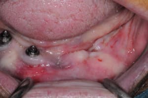 Dsc 5379 zpnaav - Eugenol