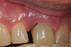 Dsc 5619 swduhq - Eugenol