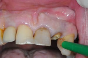 Dsc 5853 x2eucv - Eugenol