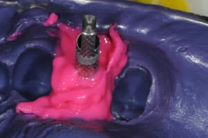 Dsc 5856 zf5gmw - Eugenol