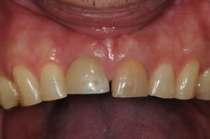 Dsc 5863 po3n1w - Eugenol