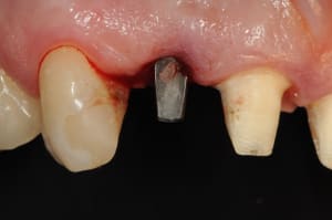 Dsc 6142 veee3q - Eugenol