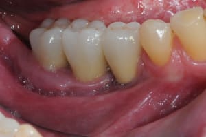Dsc 6180 jmdhpz - Eugenol