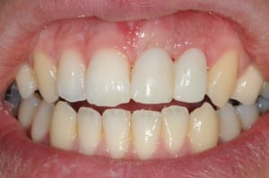 Dsc 6222 rhwmat - Eugenol
