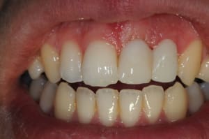 Dsc 6223 ooxuut - Eugenol
