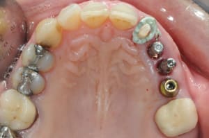 Dsc 6643 ypxjya - Eugenol