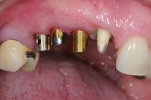 Dsc 6772 lbiqpt - Eugenol