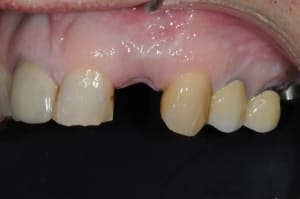 Dsc 6995 s2dii1 - Eugenol