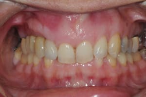 Dsc 7109 mooenh - Eugenol