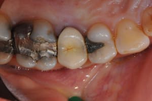 Dsc 7932 mbxdee - Eugenol