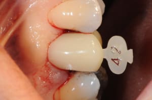 Dsc 7939 chbgsb - Eugenol