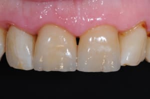 Dsc 9076 gxpycg - Eugenol