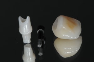 Dsc 9304 lz0dg8 - Eugenol